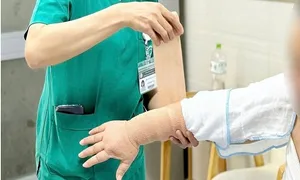 Di chứng phụ nữ đối mặt sau trị ung thư vú