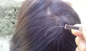 Có nên nhổ tóc bạc?