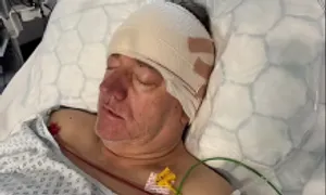 Phát hiện ung thư não giai đoạn cuối sau 24 giờ mất trí nhớ Phát hiện ung thư não giai đoạn cuối sau 24 giờ mất trí nhớ