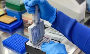 Bé gái viêm não do nhiễm cúm H5N1 sau tiếp xúc gà chết Bé gái viêm não do nhiễm cúm H5N1 sau tiếp xúc gà chết